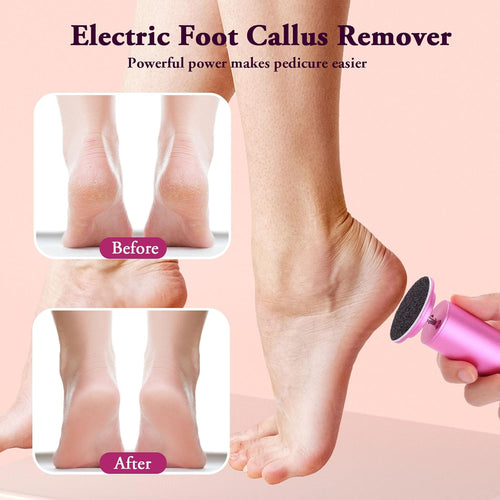 BeautyFeet